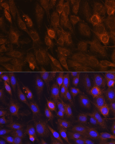 Anti-mTOR Antibody (CAB11354)