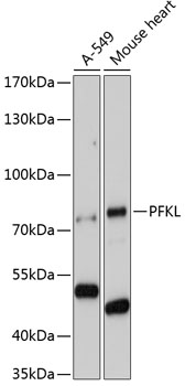 Anti-PFKL Antibody (CAB7708)