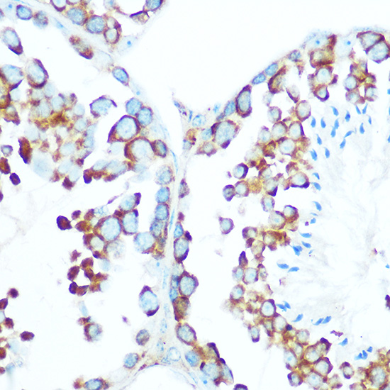 Anti-STIP1 Antibody (CAB14106)