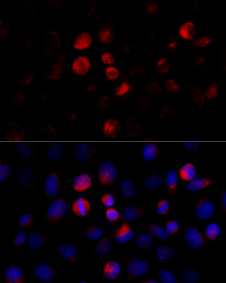 Anti-BCAP29 Antibody (CAB6335)