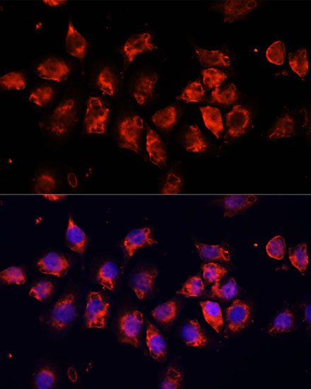 Anti-SMO Antibody (CAB3274)