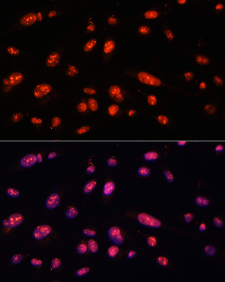 Anti-ILF3 Antibody (CAB2496)