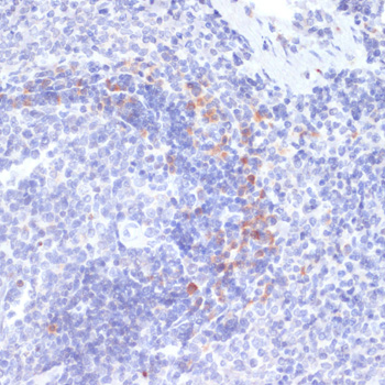 Anti-Phospho-IRE1alpha-S724 pAb (CABP0878)