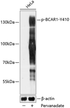 Anti-Phospho-BCAR1-Y410 pAb (CABP0789)