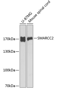 Anti-SMARCC2 Antibody (CAB1967)