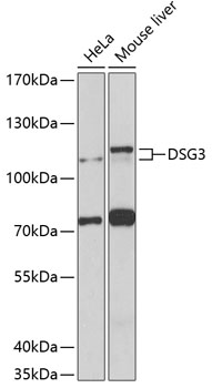 Anti-Desmoglein-3 Polyclonal Antibody (CAB8412)