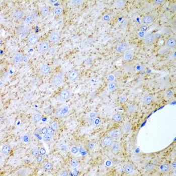 Anti-INHA Antibody (CAB1734)