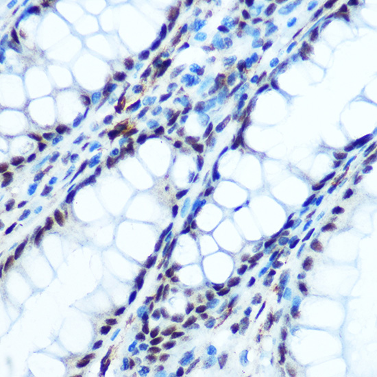 Anti-Phospho-NFKBIA-S32 Antibody (CABP0731)