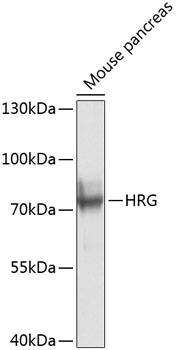 Anti-HRG Polyclonal Antibody (CAB8431)