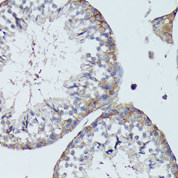 Anti-SLC7A2 Antibody (CAB14574)