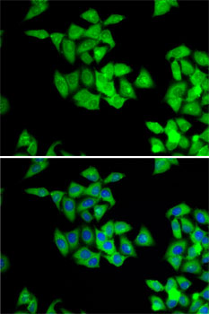 Anti-NMT2 Antibody (CAB7042)