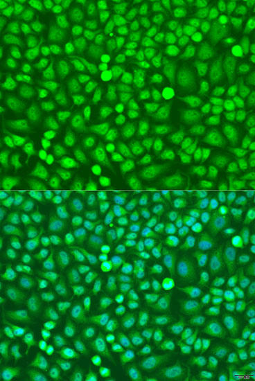 Anti-HOXB5 Polyclonal Antibody (CAB8123)