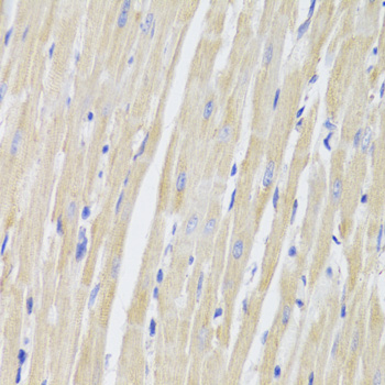 Anti-TTC11 / FIS1 Antibody [KO Validated] (CAB5821)