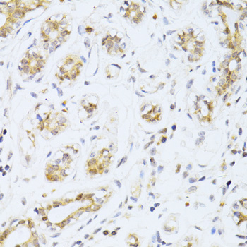 Anti-ETV1 Antibody (CAB13303)