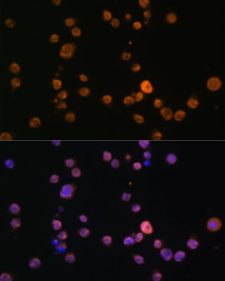 Anti-JAK3 Antibody (CAB0748)