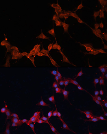 Anti-SLC25A38 Antibody (CAB13218)