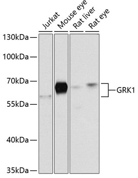 Anti-GRK1 Antibody (CAB2966)