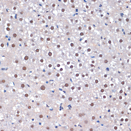 Anti-SRRT Antibody (CAB8219)