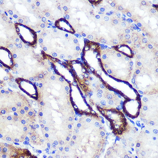 Anti-SIRT2 Antibody (CAB12575)