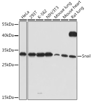 Anti-Snail Antibody (CAB5243)