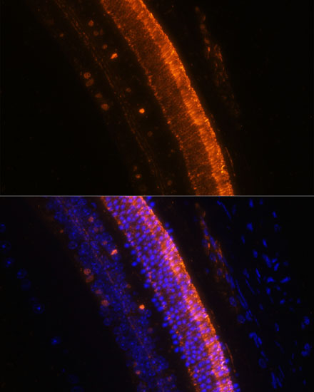 Anti-KCNS2 Antibody (CAB15684)