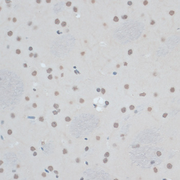 Anti-ZNF433 Antibody (CAB14972)