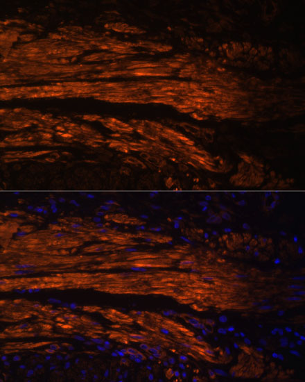 Anti-MYL9 Antibody (CAB3039)