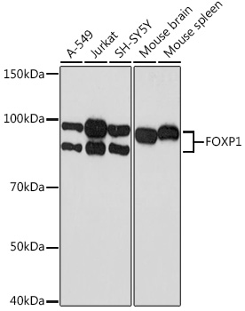 Anti-FOXP1 Antibody (CAB9540)