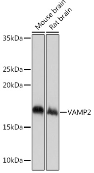 Anti-VAMP2 Antibody (CAB4235)