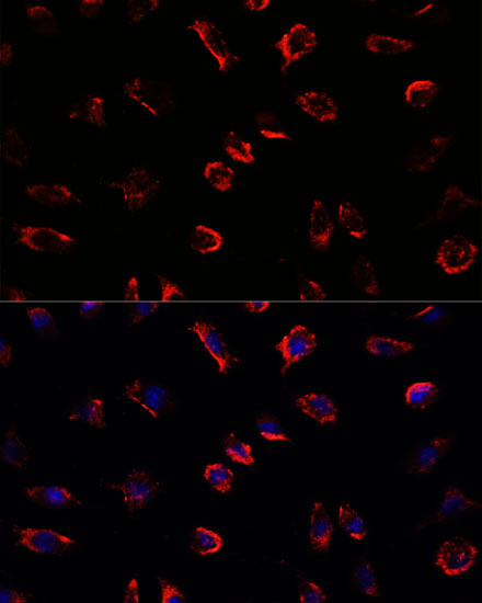 Anti-IL-11 Antibody (CAB1902)