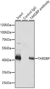 Anti-TARDBP Antibody (CAB1183)