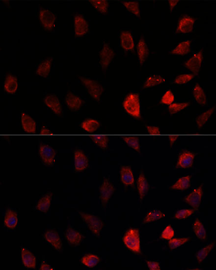 Anti-CYP11A1 Antibody (CAB16363)