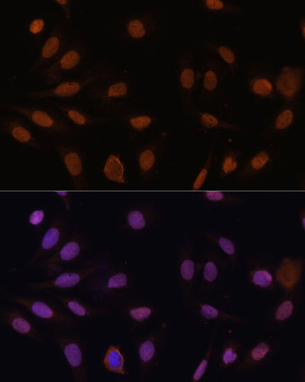 Anti-CDKN1B/p27KIP1 Antibody (CAB16722)