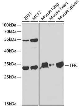 Anti-TFPI Antibody (CAB1624)