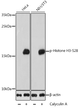 Anti-Phospho-Histone H3-S28 pAb (CABP0839)