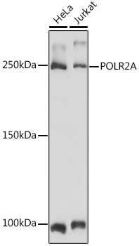 Anti-POLR2A Antibody (CAB2107)