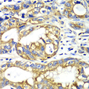 Anti-AK2 Antibody [KO Validated] (CAB6519)