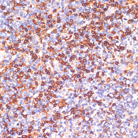 Anti-GPSM2 Antibody (CAB10553)