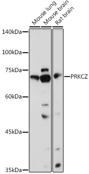 Anti-PRKCZ Antibody (CAB5714)