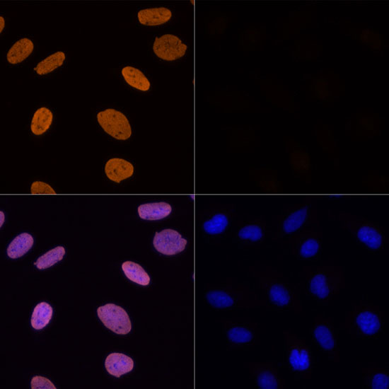 Anti-Acetyl-Histone H3-K56 Antibody (CAB7256)