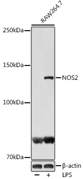 Anti-NOS2 Antibody (CAB14031)