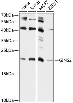 Anti-GINS2 Polyclonal Antibody (CAB9172)