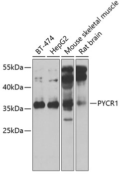 Anti-PYCR1 Antibody (CAB6959)