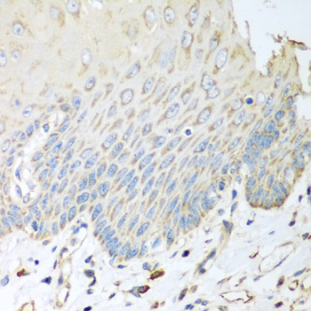 Anti-SGCB Antibody (CAB6979)