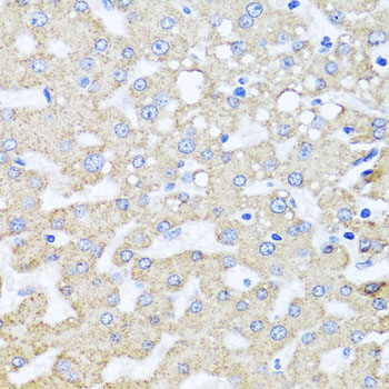 Anti-ARL6 Polyclonal Antibody (CAB8269)