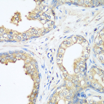 Anti-CBL Antibody (CAB0732)