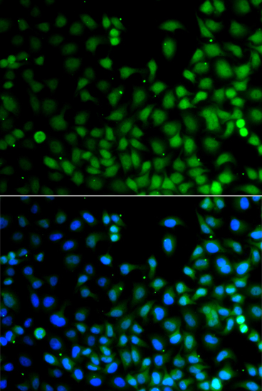 Anti-LHX6 Antibody (CAB13413)