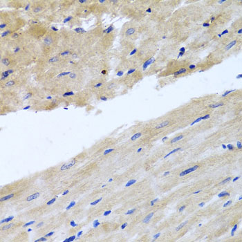 Anti-RAB24 Polyclonal Antibody (CAB8394)