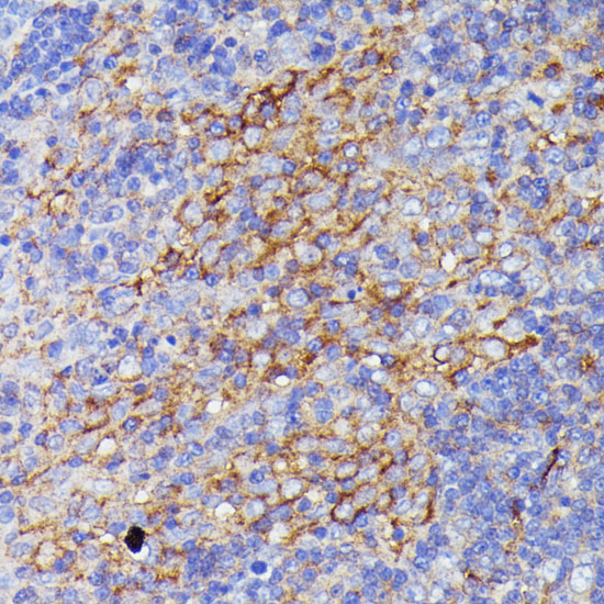 Anti-SNAP23 Antibody (CAB13909)