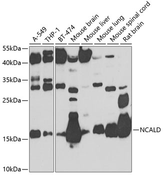 Anti-Neurocalcin-delta Polyclonal Antibody (CAB8000)